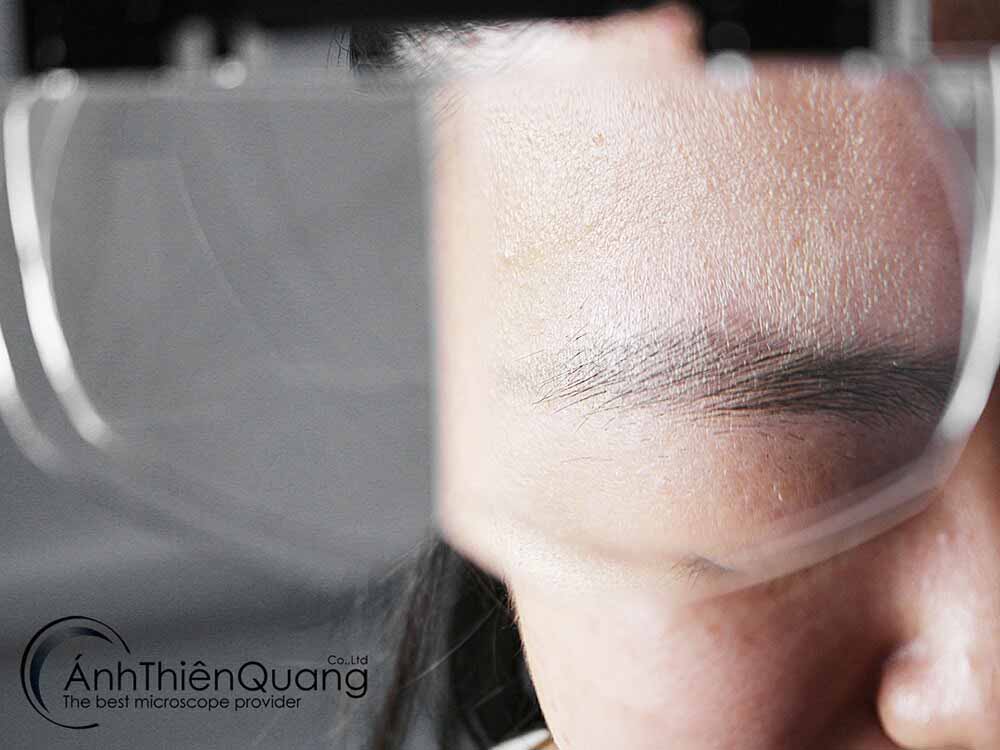 Kính lúp đội đầu MG81001-E kinh lup doi dau MG81001 E 02
